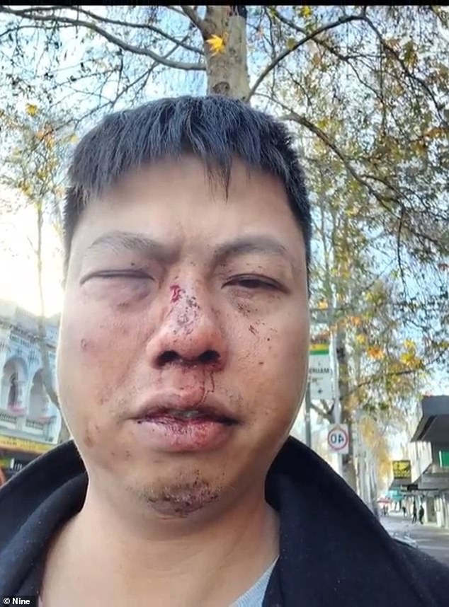 Tony Bui (pictured), 41, bravely confronted an alleged thief who is accused of nicking his brand new Kia Carnival car from the driveway of his home in Footscray, inner-city Melbourne , at 6am Saturday. He was left with a broken nose and a fractured cheek for his troubles
