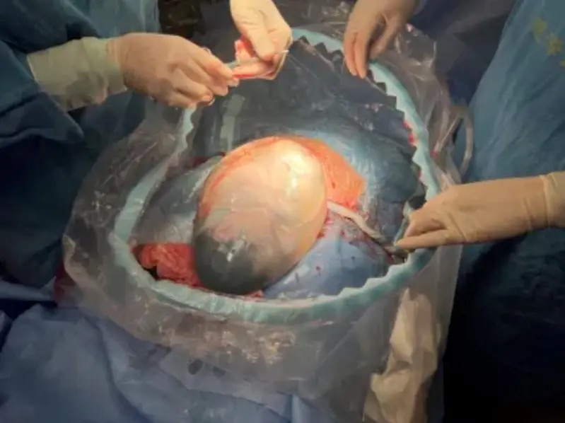 67b3cc6581e22.png image.png