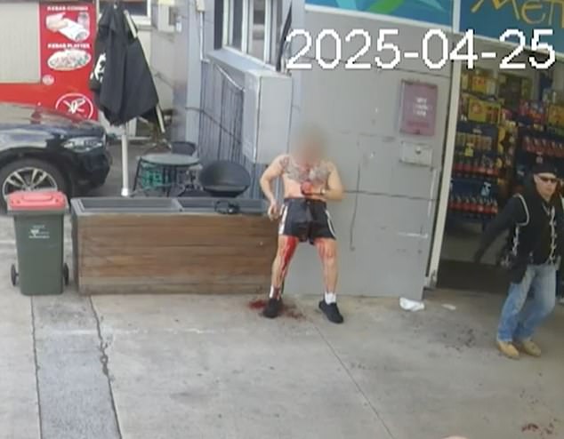 The man is seen leaning against the wall of a petrol staton as blood runs down this leg