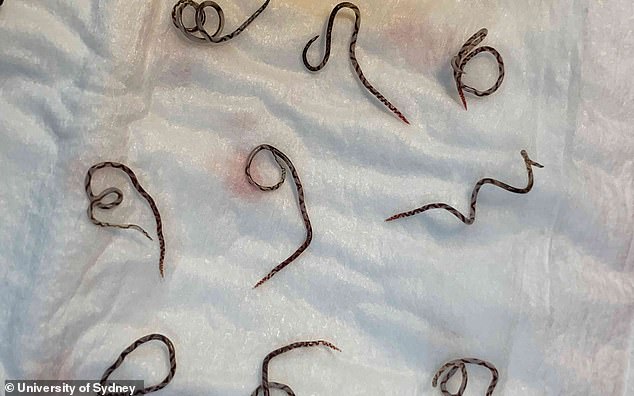 Rat lungworms (pictured) can have potentially harmful affects in humans if consumed