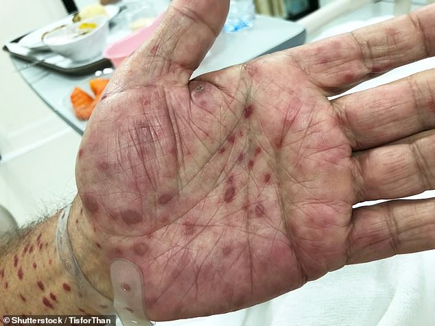 Not all patients will present with symptoms, meaning regular testing is crucial (stock)