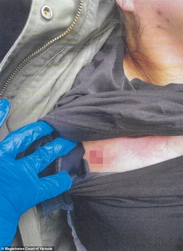 Sushi chef Wan Lai was allegedly stabbed in the chest. Above, a picture of her injuries, as tendered in court