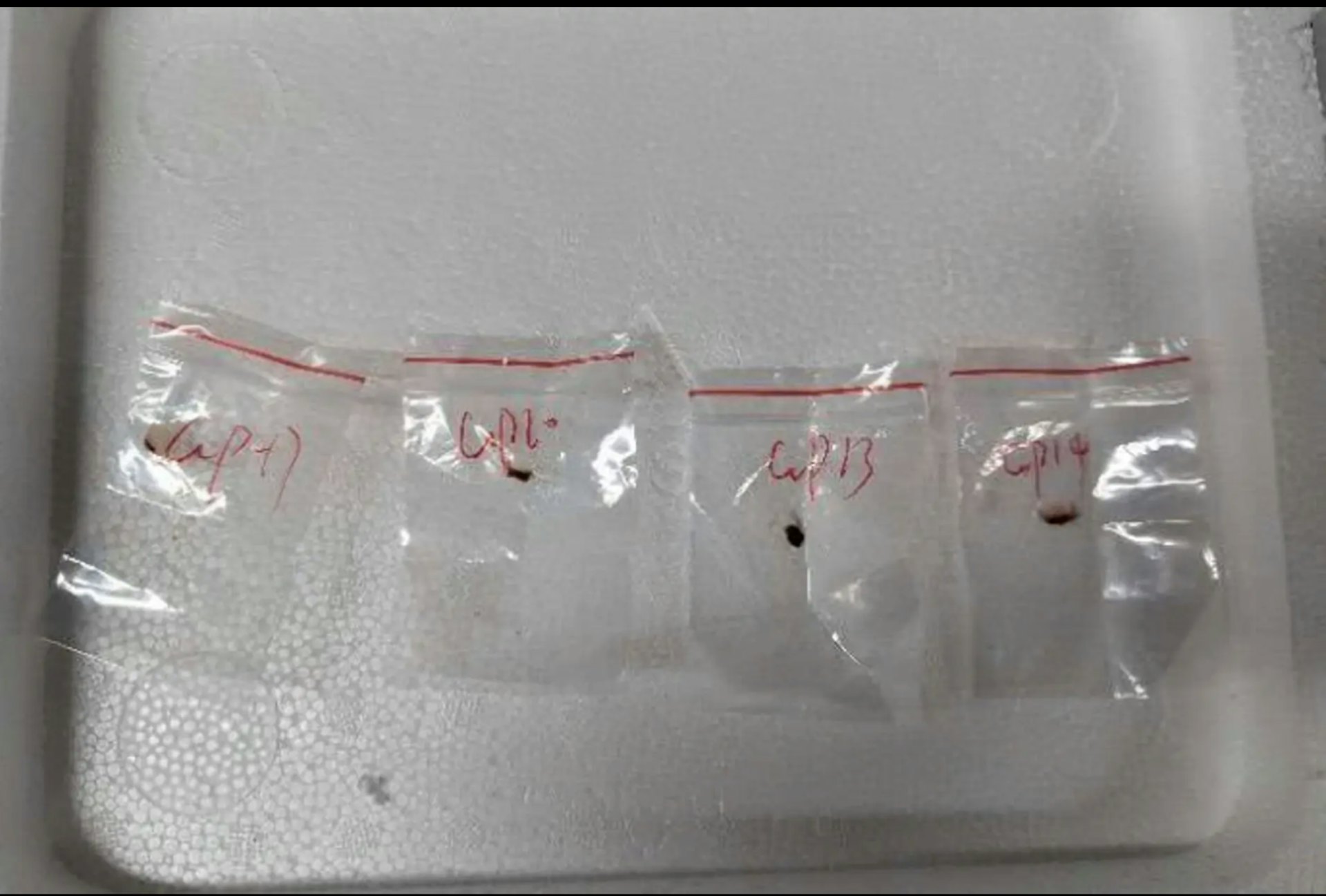 2025年12月1日，密歇根大学研究人员Yunqing Jian早前涉嫌将植物病原体走私进入美国研究，并向联邦调查局（FBI）撒谎，因而被控「共谋、走私、虚假陈述与签证诈欺」罪成。联邦调查局副局长丹邦吉诺（Dan Bongino）表示，Yunqing Jian在被定罪后已被驱逐出境。图为Yunqing Jian与男友走私的有毒真菌。（网络图片）