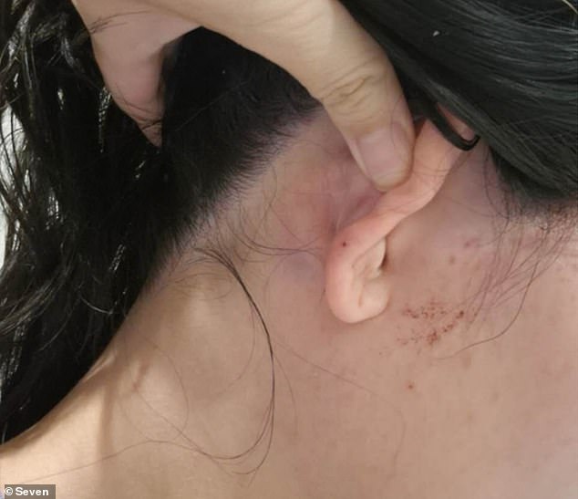 Her wounds were cleaned up but she bled heavily from the ear and nose