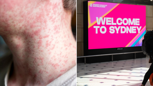 New measles case in Sydney sparks warnings for locals and travellers with  airport and trains among risk sites | 7NEWS