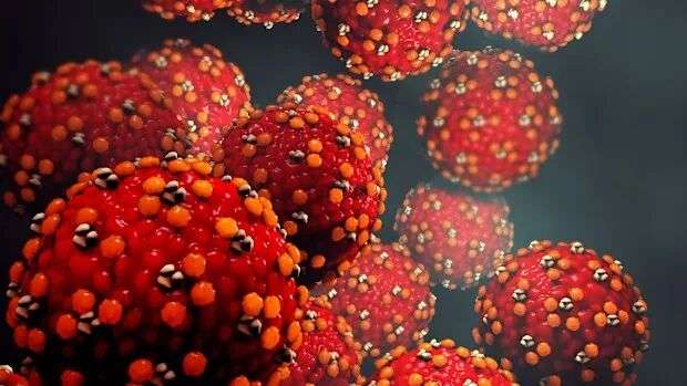 Measles alert for Sydney Airport and western NSW after infected traveller  returns from Asia | Nine.com.au